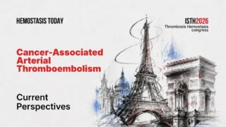 Cancer-Associated Arterial Thromboembolism: Redefining the Thrombotic Burden in Oncology