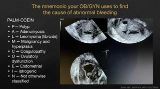 Asima Ahmad: Decoding Heavy Bleeding - What Your Symptoms Could Be Telling You