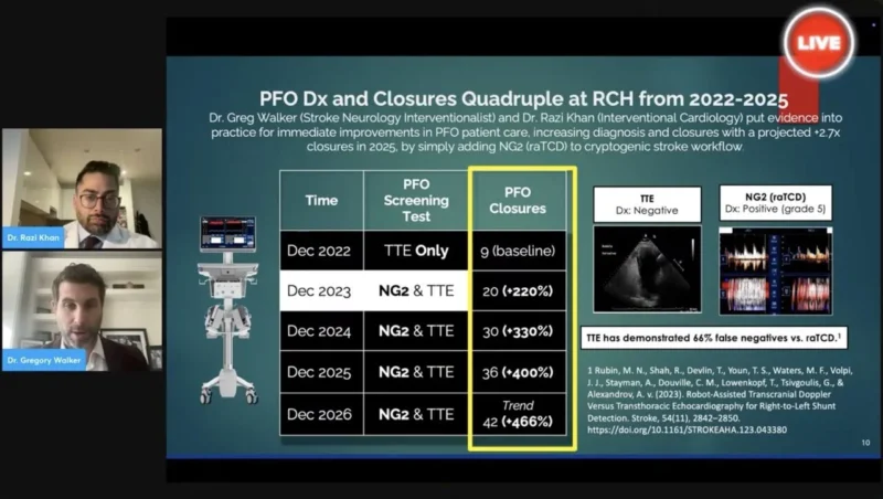 Robert Hamilton: A New ''Game-Changing'' Approach for Identifying PFOs in Stroke