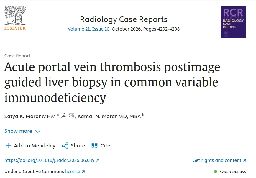 Satya K. Morar: Acute Portal Vein Thrombosis as an Exceptionally Rare Complication of Liver Biopsy in CVID 1 Satya K. Morar