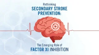Rethinking Stroke Prevention - New Frontiers in Minimizing Bleeding Concerns - ISTH