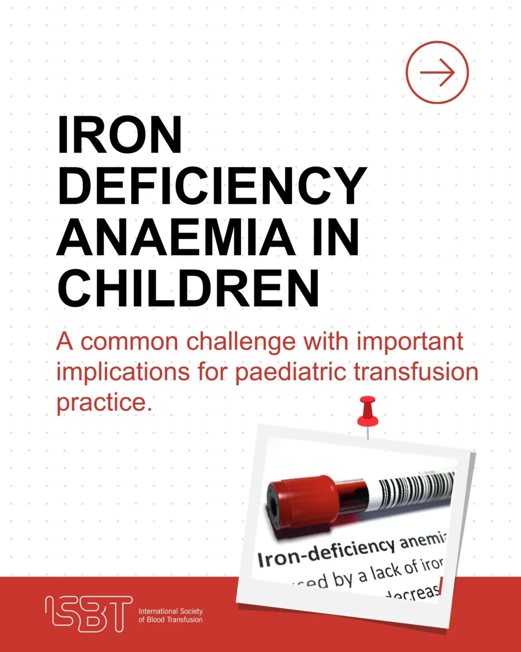 Identifing Gaps in How IDA is Recognised and Managed in Children - ISBT 1 ISBT