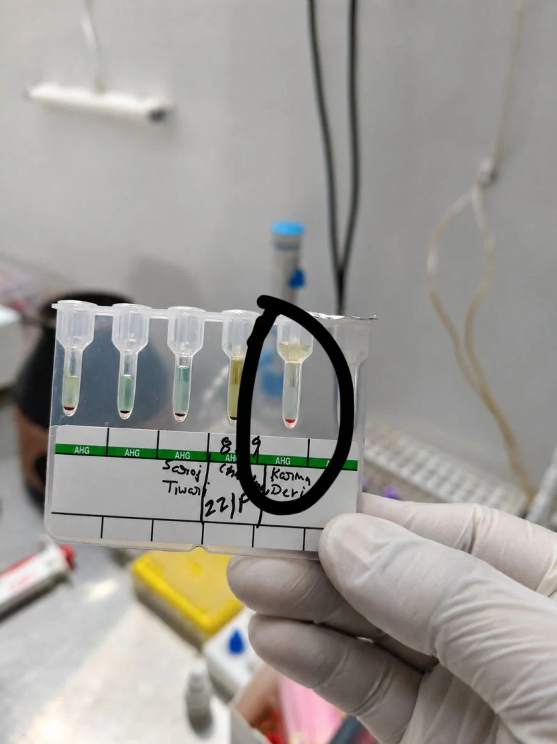 Mohd Ashhad: The Science Behind a Safe Transfusion 1 Mohd Ashhad: The Science Behind a Safe Transfusion