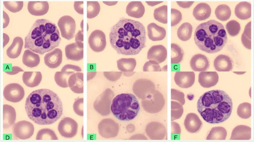 Sally Mandour: Can a Blood Smear Diagnose Heatstroke?