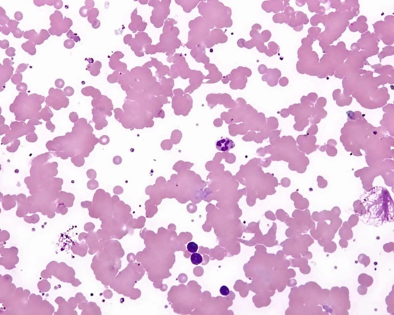Saqib Ullah: Why Do Red Blood Cells Autoagglutinate