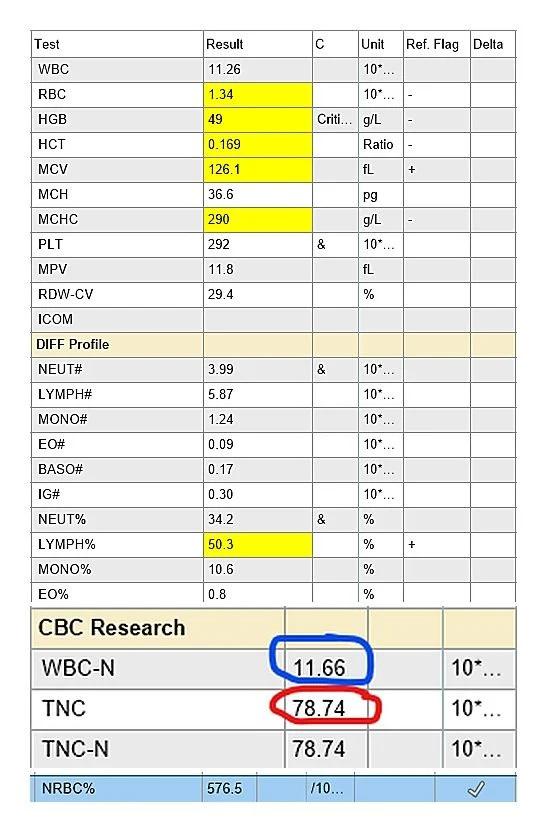 Saleh Shamse Basha: Severe Neonatal Anemia – When the Analyzer Tells a Story Before the Slide Does 1 Saleh Shamse Basha: Severe Neonatal Anemia – When the Analyzer Tells a Story Before the Slide Does