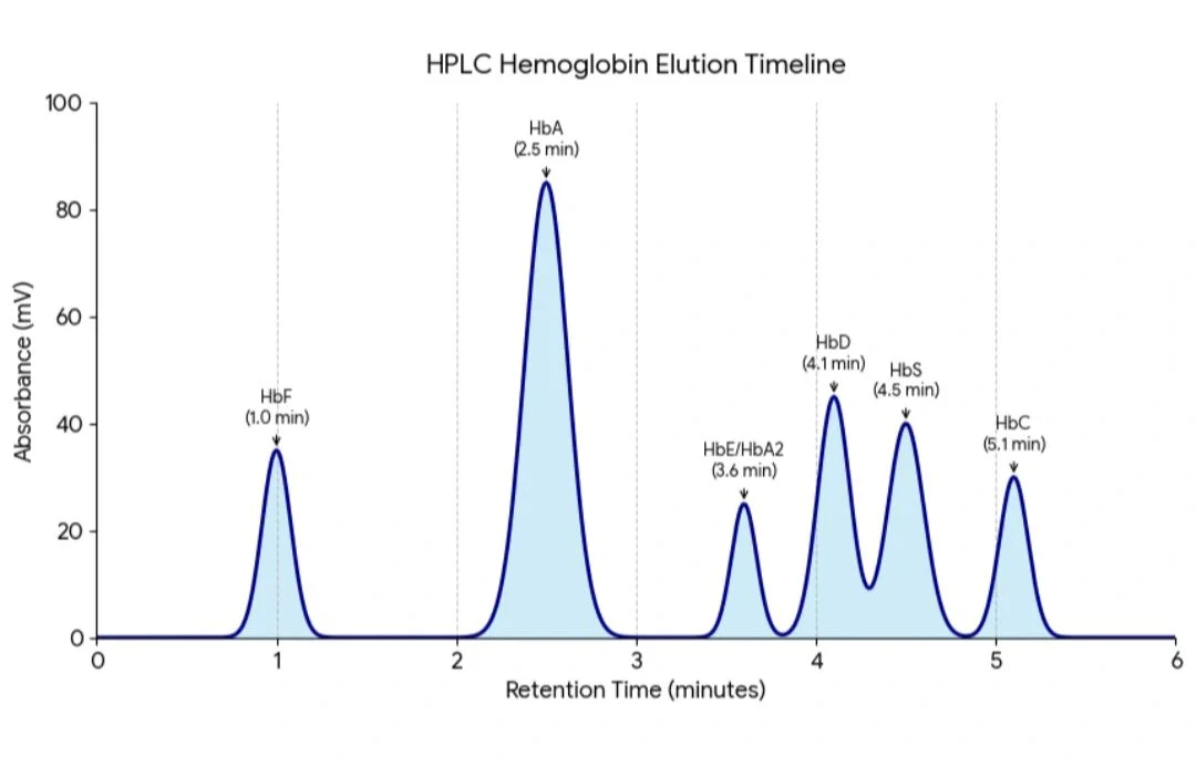 Salih Ehsan: Diagnostic Screening Strategy for Hemoglobinopathy Traits