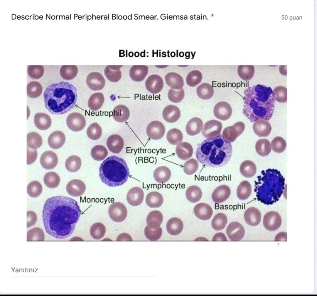 Seema Dawood: Why the Peripheral Blood Smear Still Matters in the Age of Automation? 1 Seema Dawood: Why the Peripheral Blood Smear Still Matters in the Age of Automation?