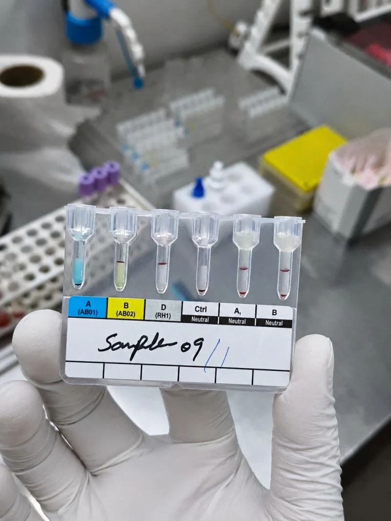 Mohd Ashhad։ Quality Control in the Blood Bank 1 Mohd Ashhad։ Quality Control in the Blood Bank
