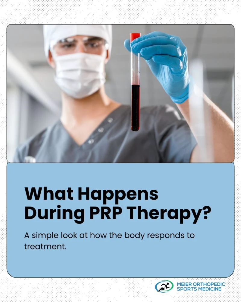 Steven Meier: What Happens During PRP Therapy? 1 Steven Meier: What Happens During PRP Therapy?