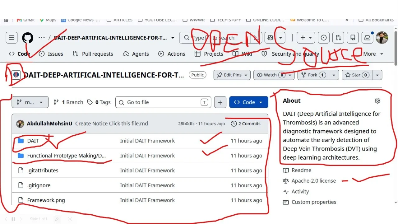Abdullah Mohsin: Open-Source DVT Diagnostic Framework Launches on GitHub