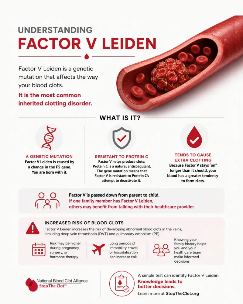 Breck Gamel: Why Factor V Leiden Matters 1 Breck Gamel: Why Factor V Leiden Matters