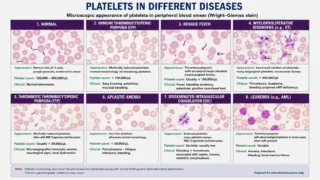 Tushar Namdeo: Platelets in Different Diseases