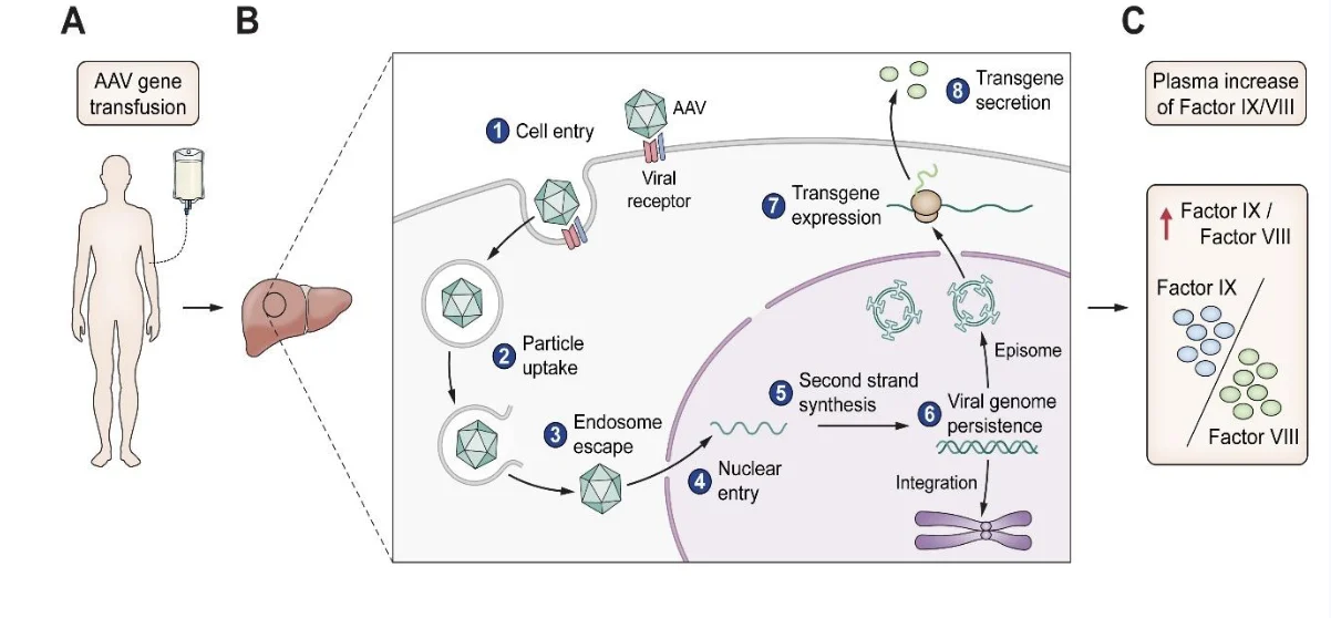 The Evolving Treatment Landscape of Hemophilia: From Factor Replacement to Gene Therapy