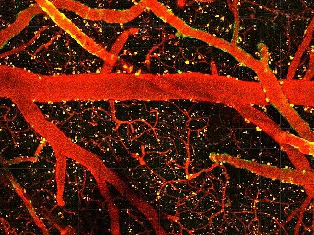 Nicolas Hubacz: How Pericytes Control Blood Flow in the Brain 1 Nicolas Hubacz: How Pericytes Control Blood Flow in the Brain