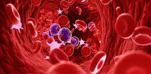 Nova Sinclair: The Changing Landscape of Blood Disorders
