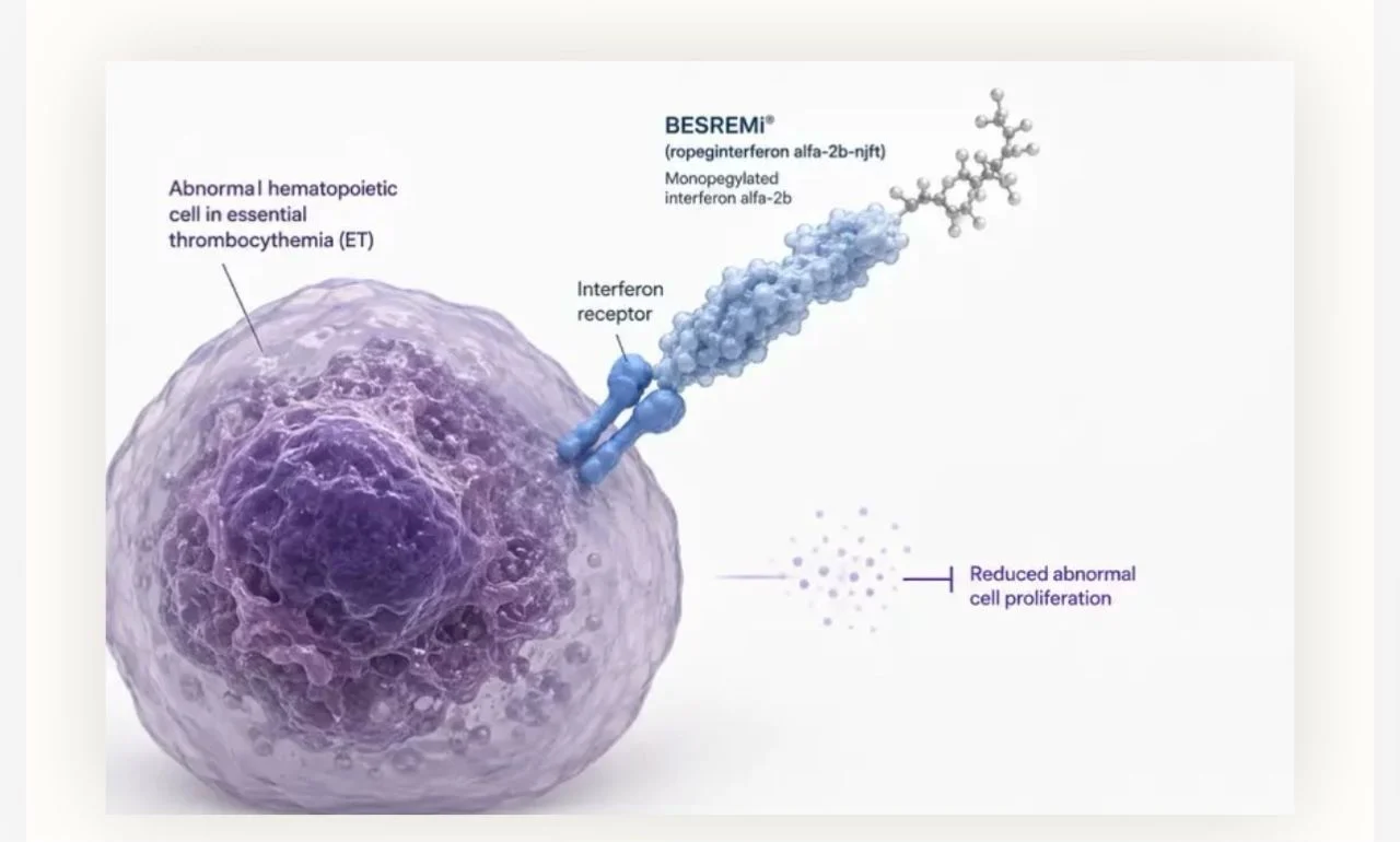 Faheema Hasan: A New Second-Line Therapy for Essential Thrombocythemia