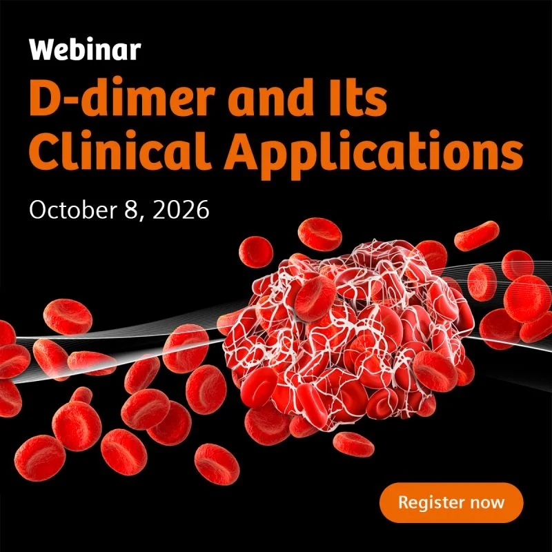 Carrie Gillies: Join the D-Dimer Webinar - From Testing to Clinical Decisions 1 Carrie Gillies: Join the D-Dimer Webinar - From Testing to Clinical Decisions