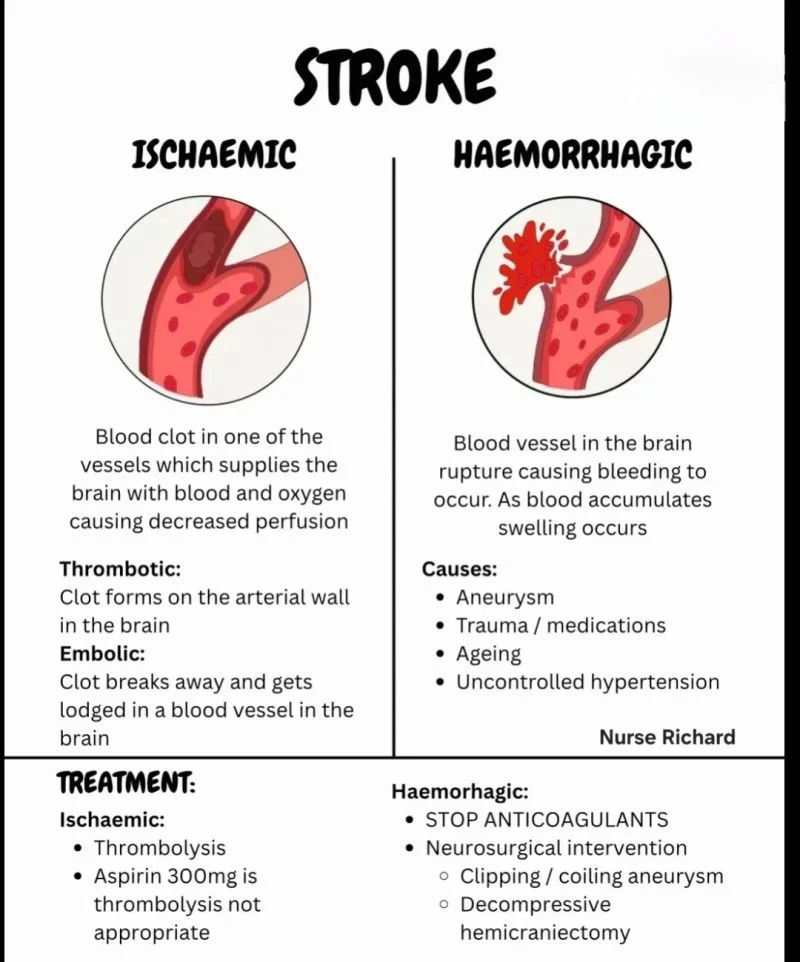 Ocima Richard Draza: A Guide to Stroke Types and Complications