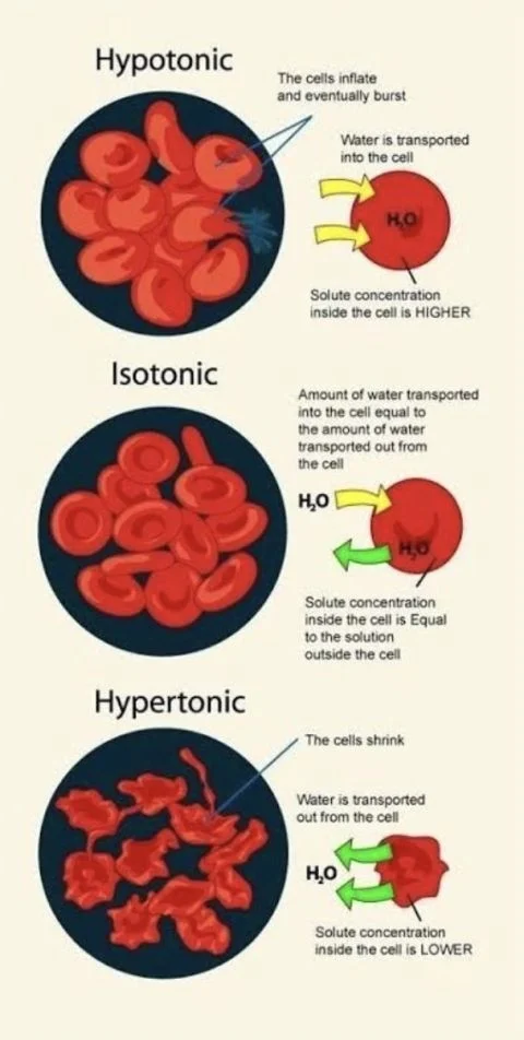 Seema Dawood: Why Some Red Cells Break While Others Survive? 1 Seema Dawood: Why Some Red Cells Break While Others Survive?