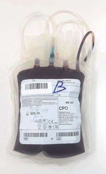 Maxime Dely: When ABO Compatibility Isn’t Enough for Safe Transfusion 1 Maxime Dely: When ABO Compatibility Isn’t Enough for Safe Transfusion