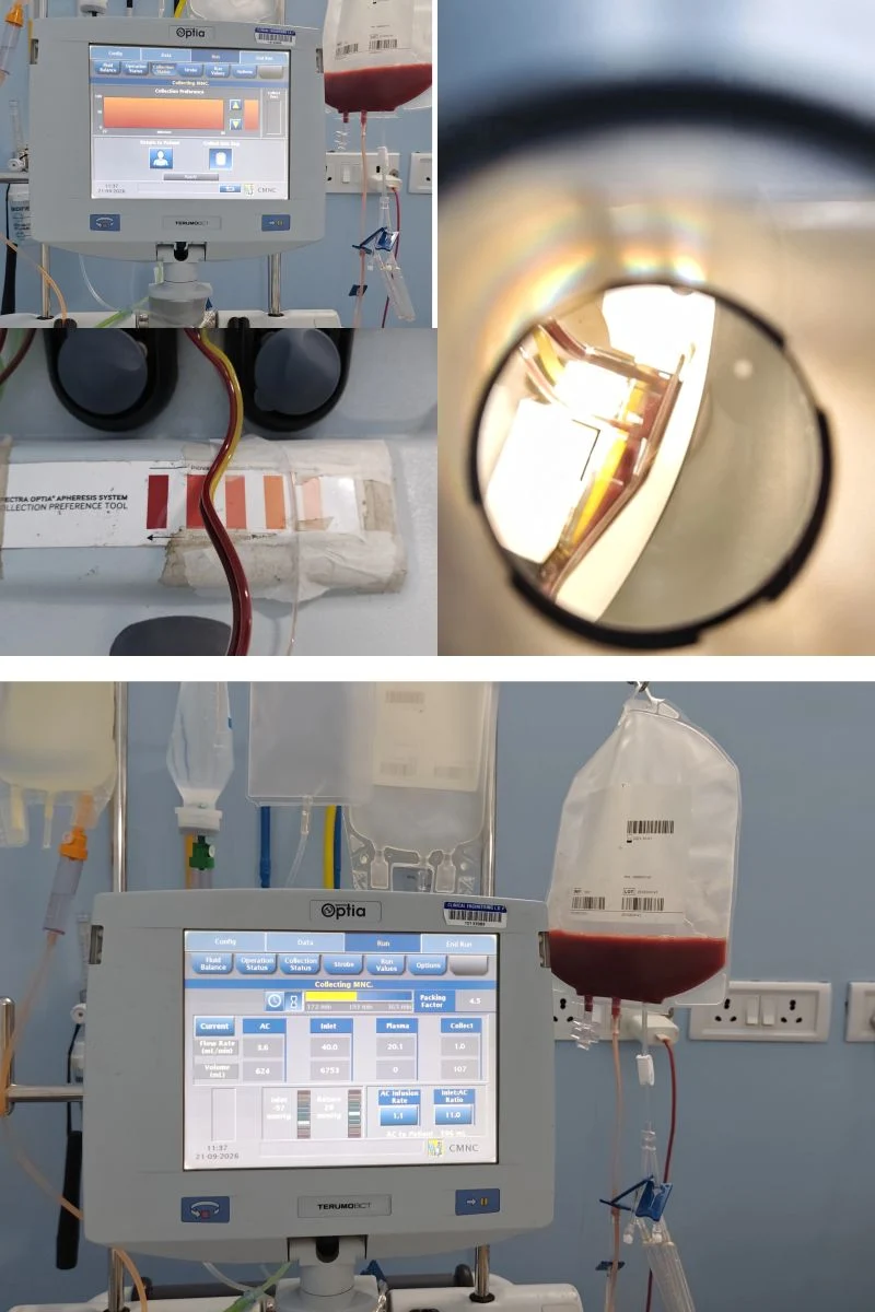 Sumita Pandey: Apheresis Beyond Automation