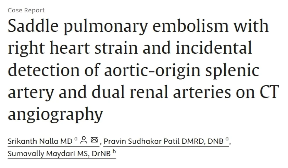 Srikanth Nalla: A Case of Saddle Pulmonary Embolism 1 Srikanth Nalla: A Case of Saddle Pulmonary Embolism
