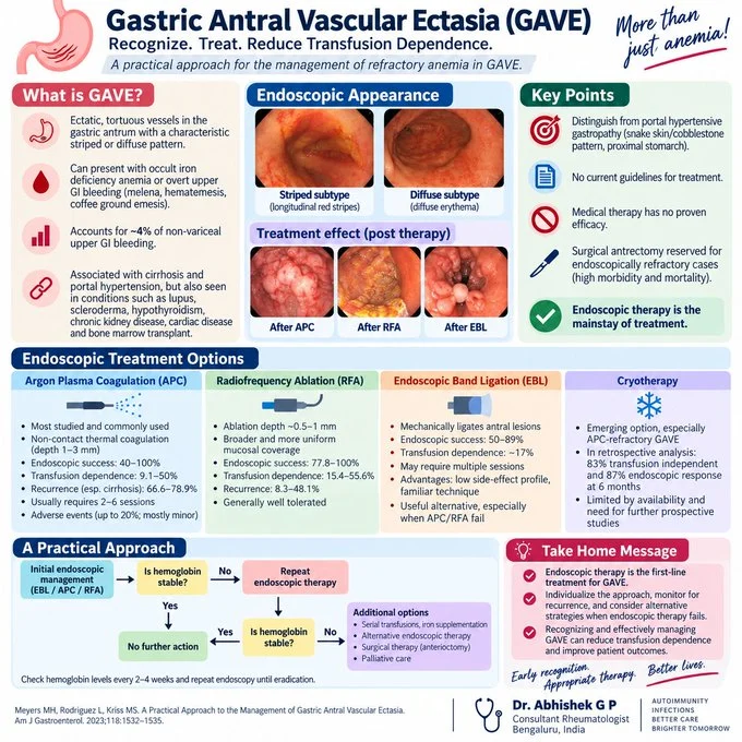 Abhishek G P: GAVE as an Important Cause of Chronic Gastrointestinal Blood Loss