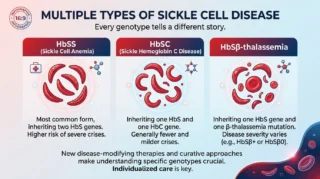 Shabnam Arsiwala: Did You Know there are Multiple Types of Sickle Cell Disease?