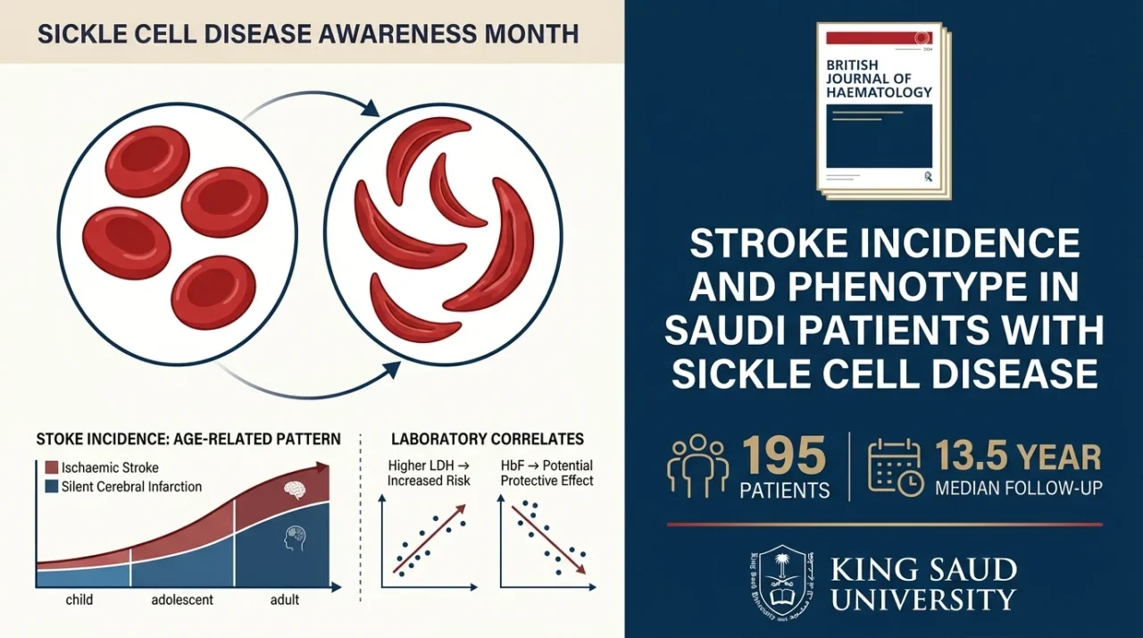 Farjah Algahtani: Stroke Incidence and Risk Factors in Saudi Patients with Sickle Cell Disease