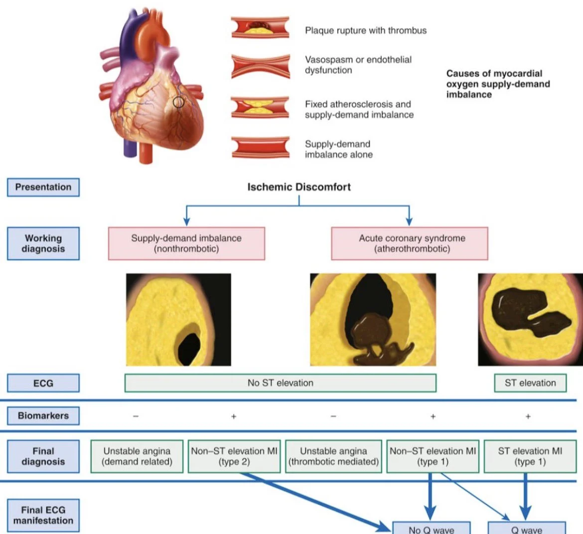 Zain Khalpey: Why the Underlying Mechanism Matters in Myocardial Ischemia