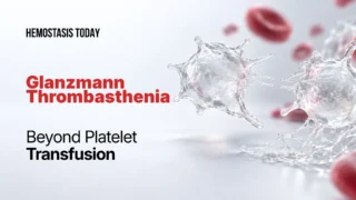 Glanzmann Thrombasthenia Beyond Platelet Transfusion