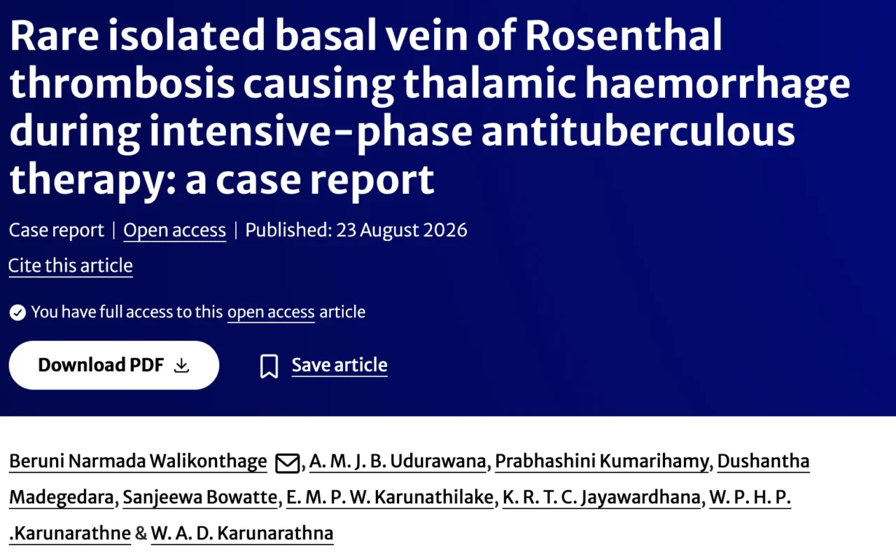 Beruni Narmada W: Rare Basal Vein of Rosenthal Thrombosis Presenting With Thalamic Haemorrhage