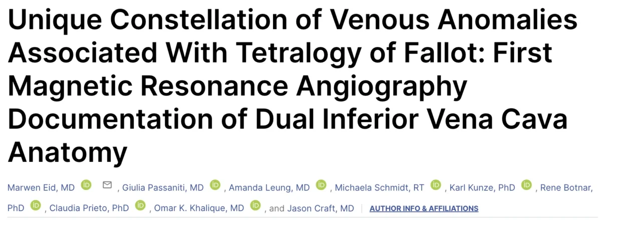 Giulia Passaniti: Dual Inferior Vena Cava Anatomy in Tetralogy of Fallot