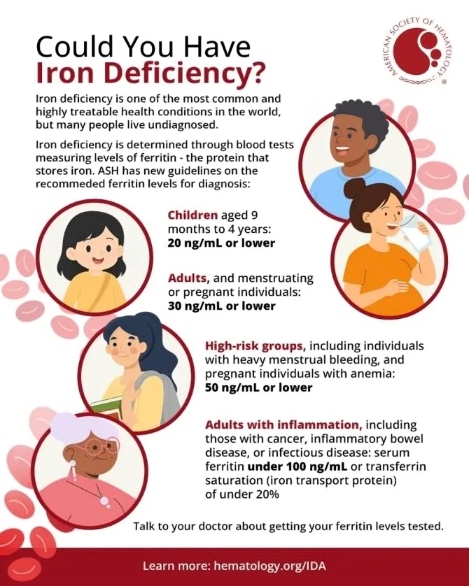 Fatima Zahra: ASH Released New Guidelines on the Diagnosis of Iron Deficiency