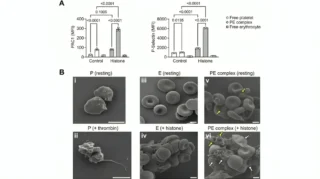 Blocking Histone-Induced Platelet-Erythrocyte Interactions With Polyanions - Platelets Journal