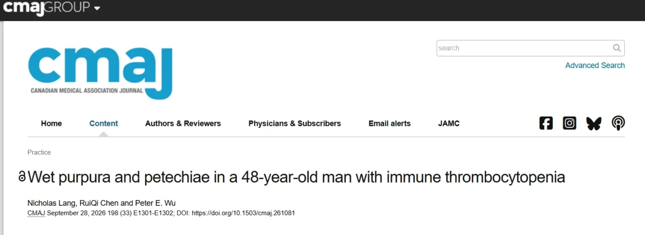 Nicholas Lang։ A Meaningful Case of Immune Thrombocytopenia