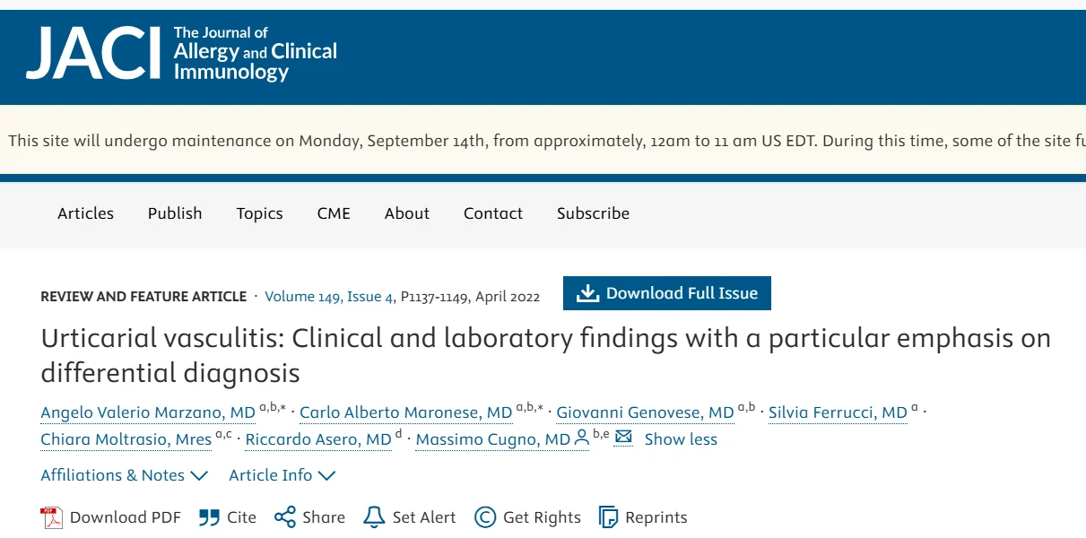 W. Alberto Sifuentes Giraldo: Urticarial Vasculitis Clinical Features, Systemic Involvement, and Treatment