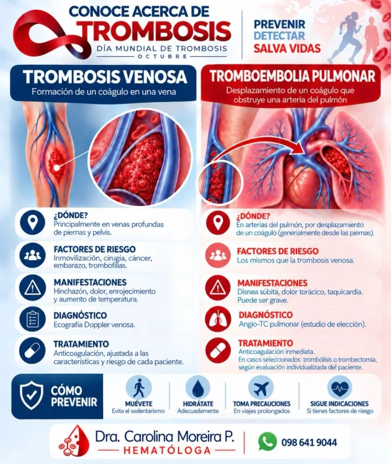 Carolina Moreira Ponce: Thrombosis Month - Why Prevention Starts With Risk Assessment
