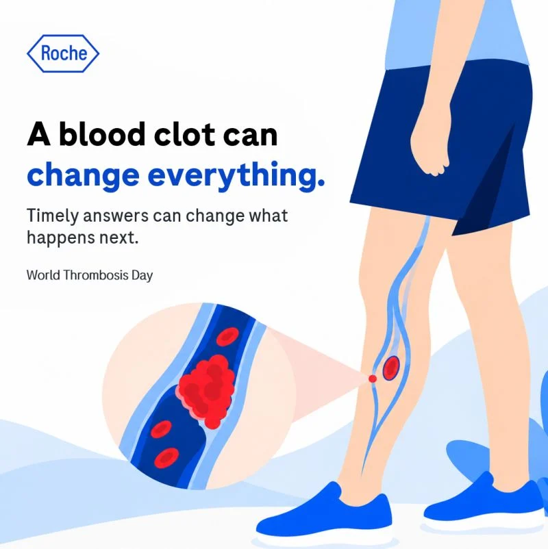Thrombosis Awareness Must Lead to Timely Action - Roche