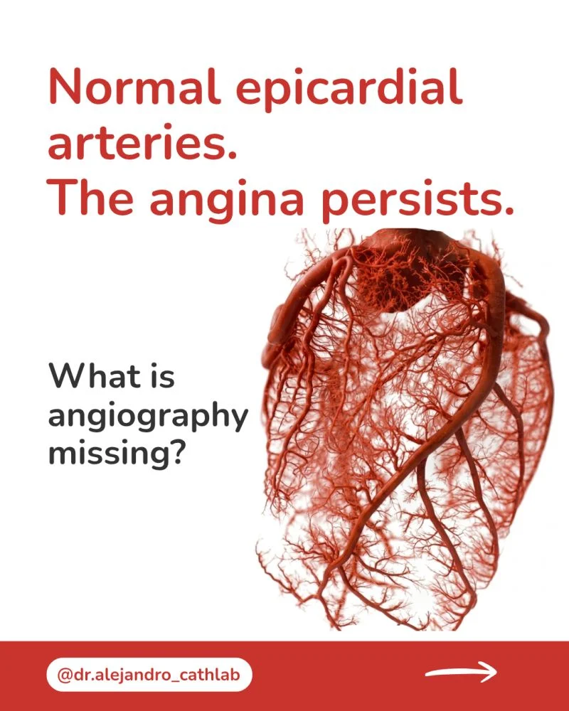 Alejandro González Veliz: Looking Beyond Coronary Anatomy to Understand Ischemia 1 Alejandro González Veliz: Looking Beyond Coronary Anatomy to Understand Ischemia