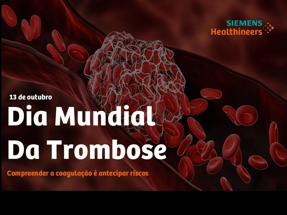 Thaís Leonel: Analytical Consistency as a Foundation for Evidence-Based Thrombosis Management 1 Thaís Leonel: Analytical Consistency as a Foundation for Evidence-Based Thrombosis Management