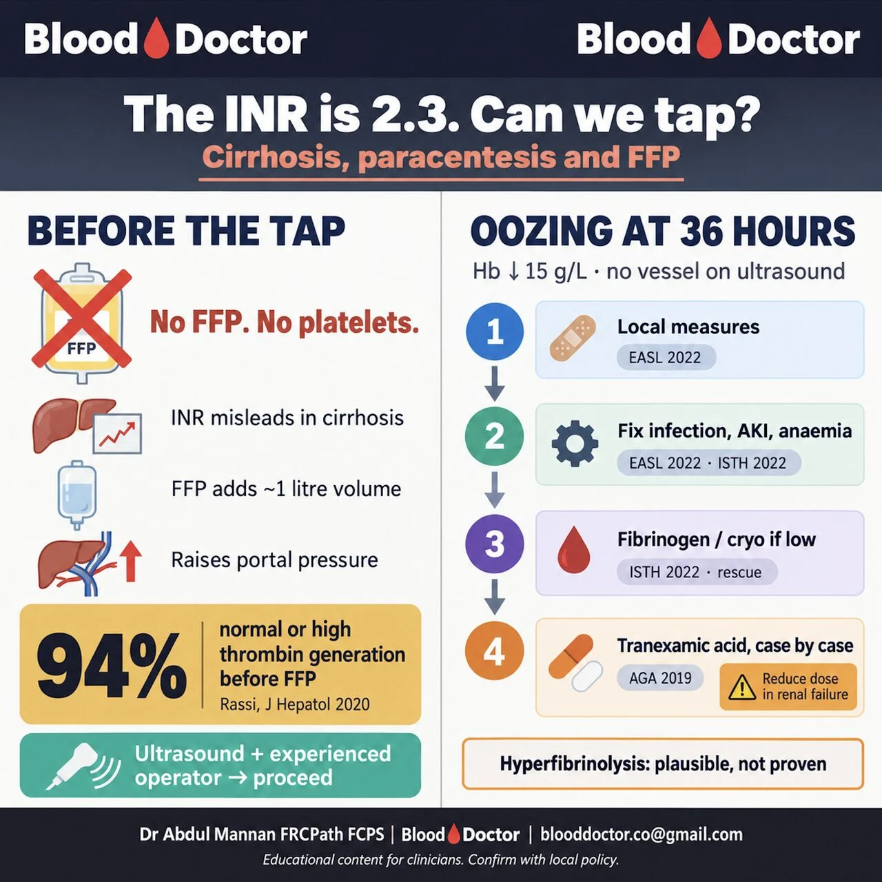 Abdul Mannan: When INR Misleads - Rethinking Bleeding Risk in Cirrhosis 1 Abdul Mannan: When INR Misleads - Rethinking Bleeding Risk in Cirrhosis