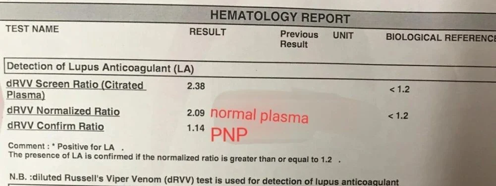 Sally Mandour: Lupus Anticoagulant-The Tree Key Diagnostic Criteria