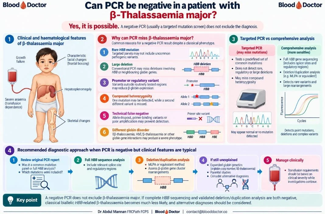Abdul Mannan: A Negative PCR Does Not Exclude β-Thalassaemia