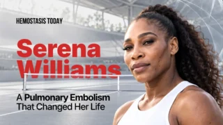 Serena Williams and Pulmonary Embolism: From Personal Crisis to Lessons in Venous Thromboembolism