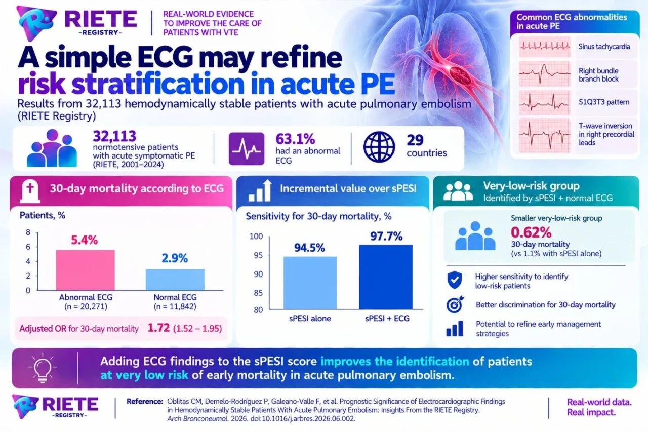 Manuel Monreal: ECG Improves Risk Stratification in Acute Pulmonary Embolism