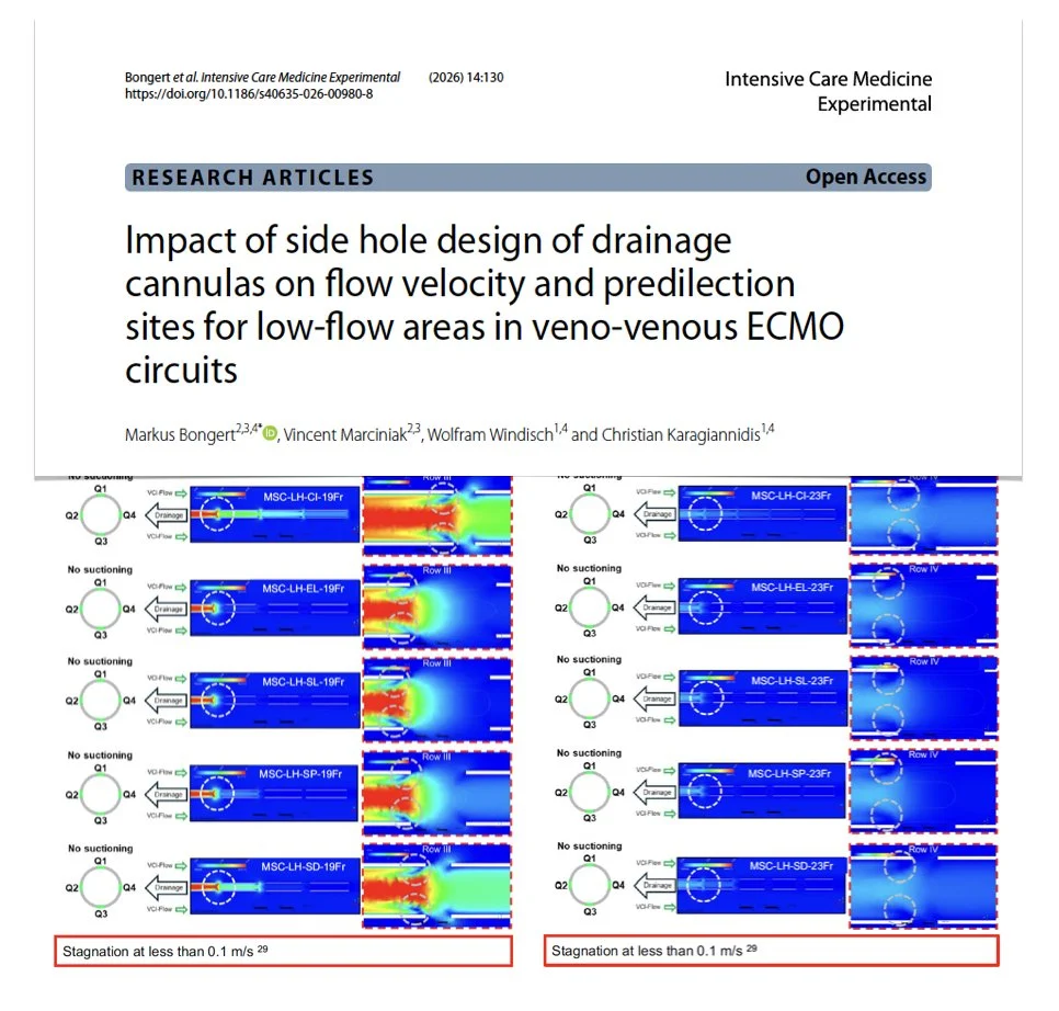 M Velia Antonini: ECMO Cannula Design and Its Impact on Blood Flow, Thrombosis and Hemolysis 1 M Velia Antonini: ECMO Cannula Design and Its Impact on Blood Flow, Thrombosis and Hemolysis