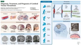 Sthanu Subramanian: Mechanisms, Clinical Phenotypes, Imaging, and Treatment of CVT