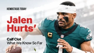 Jalen Hurts Sidelined by a Superficial Blood Clot: What to Know
